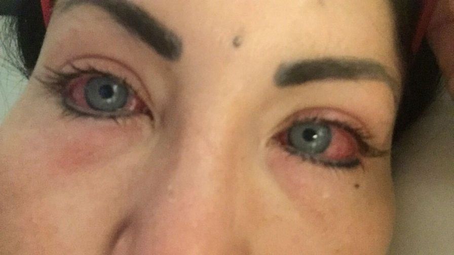 Laser Eye Color Change change comin